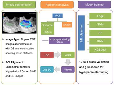 Optimizing evaluation of endometrial receptivity in recurrent pregnancy loss: a preliminary investigation integrating radiomics from multimodal ultrasound via machine learning